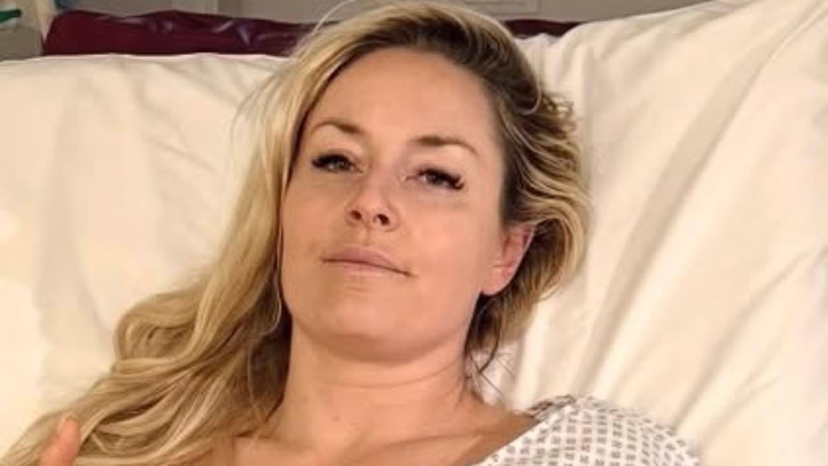 Lindsey Vonn's surgeon speaks out amid amputation fears to reveal star's 'delicate' situation after horror Winter Olympics crash