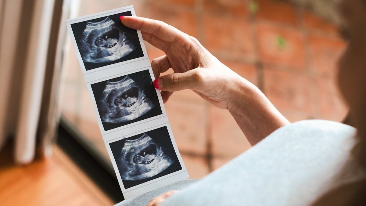 Fury as NHS tells midwives to back cousin marriage as 'only' 15 per cent have deformed babies