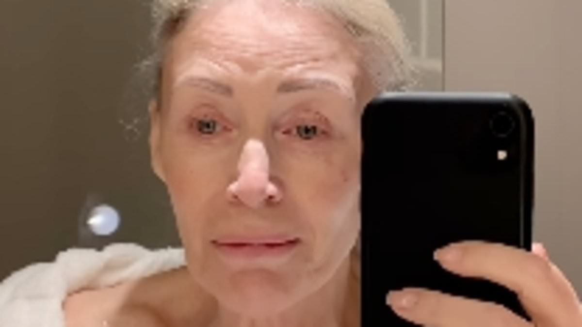 Angie Best, 73, issues chemotherapy update after travelling to Switzerland for unconventional mistletoe treatment in her battle with colon cancer
