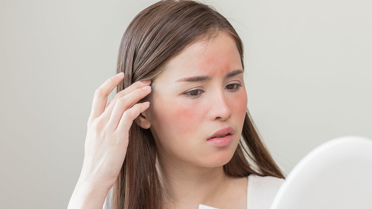 Have you got 'central heating face'? Why your skin is red and dry during the cold snap - and how to fix it, according to a dermatologist
