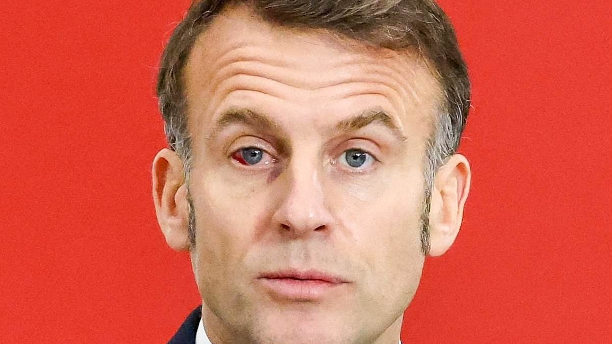 Top surgeon gives his verdict on Emmanuel Macron's severely bloodshot eye... and it's a condition that CAN be caused by a slap to the face