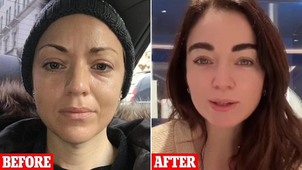 I was so embarrassed by my thin eyebrows I tried to cover them up with tattoos and even grew a fringe, but nothing worked. Then I tried this one treatment - I'm so happy with the results