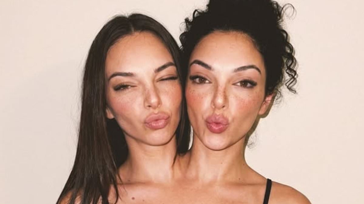 Millions have been fooled by beautiful AI-generated conjoined twin influencers... but the reality of the rare birth defect is anything but glamorous