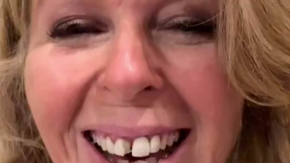 Kate Garraway suffers behind-the-scenes 'horror' as taxi crash causes her front teeth to fall out just before going live on GMB - as presenter jokes she now knows how Alan Carr feels