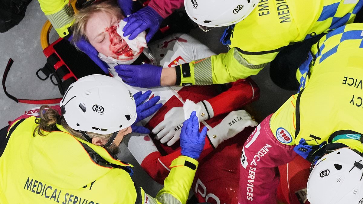 Horrifying moment Winter Olympics speed skater is slashed above the EYE by rival's blade