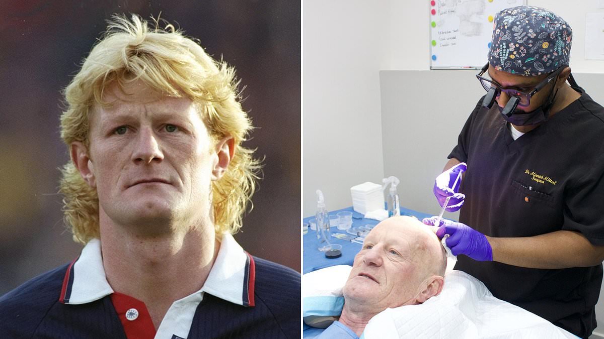 EDEN CONFIDENTIAL: The bald truth... Football legend Colin Hendry to tell all about his hair loss and court case