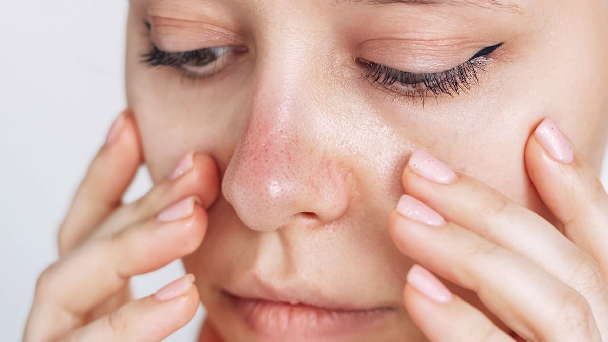 For the past 18 months I have suffered with a very cold nose. My fingers, toes and the rest of my body are all fine... what is wrong with me? DR SCURR reveals the little-known immune condition that could be to blame