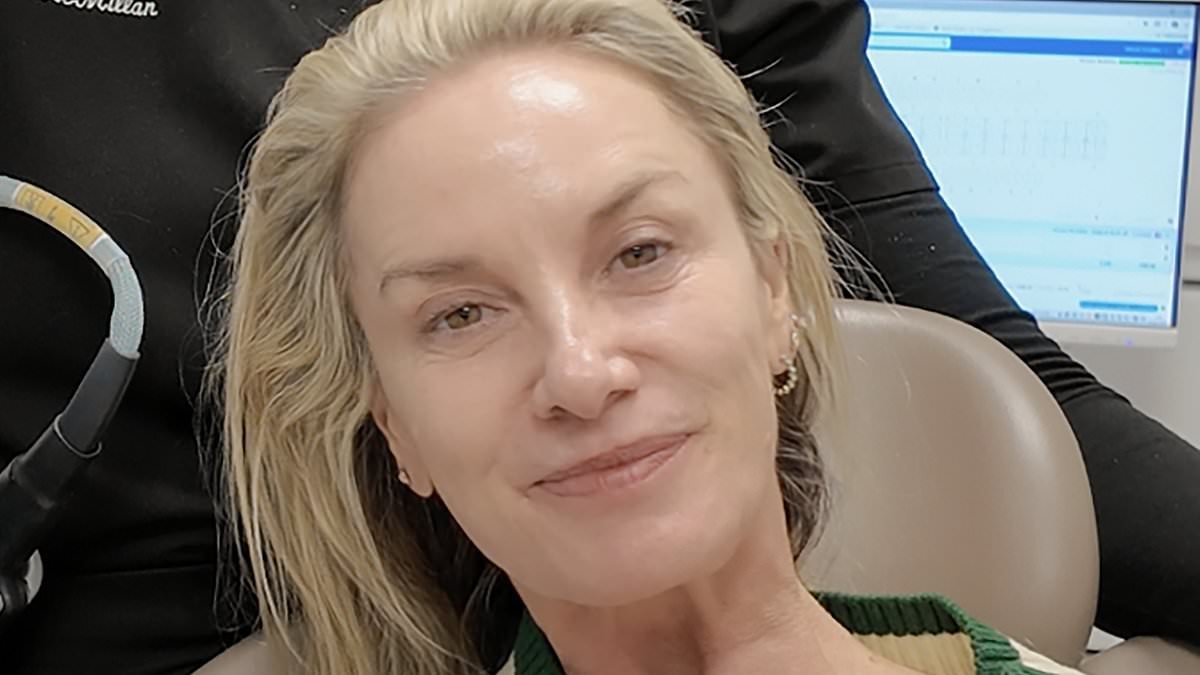 Tamzin Outhwaite, 55, reveals the incredible results of her £5K non-surgical facelift after 'feeling down' about her looks