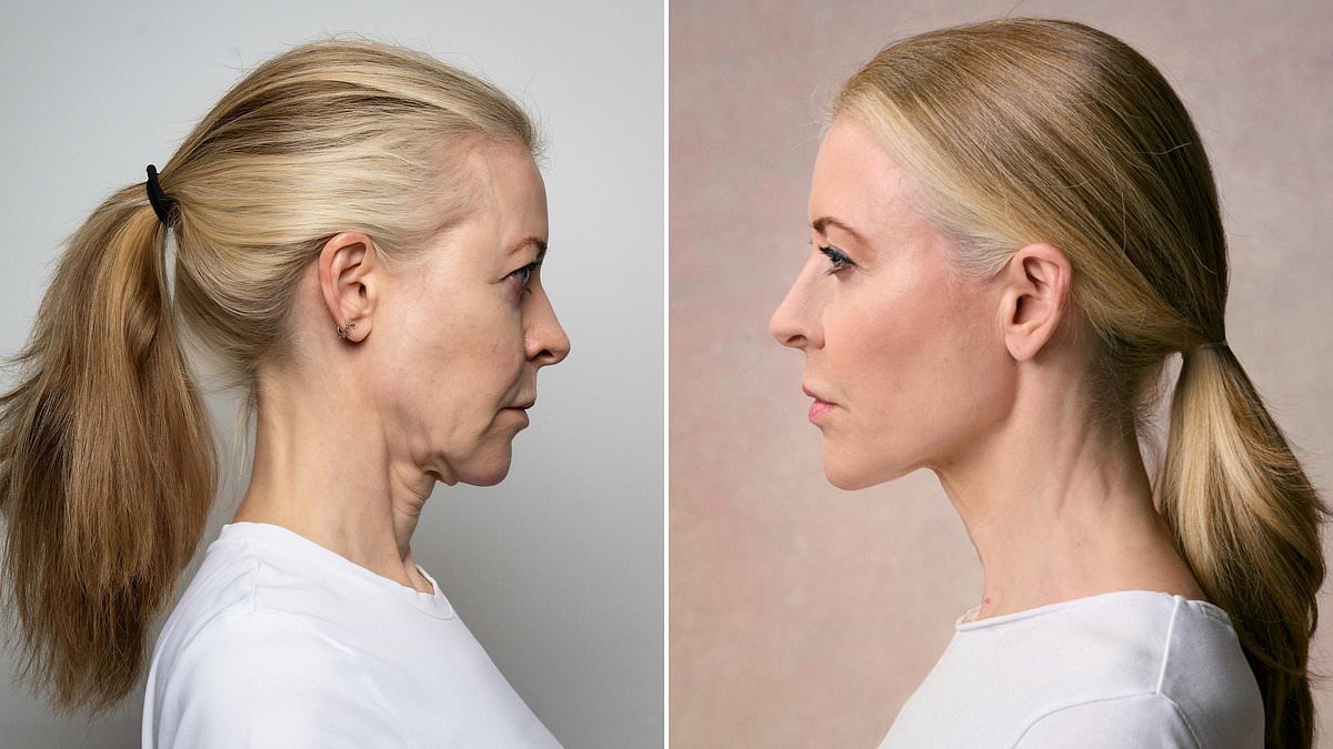 How I fixed my 62-year-old wrinkly neck in just 15 minutes WITHOUT surgery: It's one of the hardest areas to treat particularly if you lose weight. Now there's a game-changing answer... and I'm proof it works