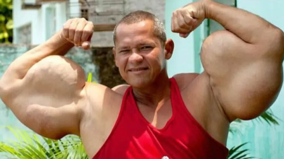 'Brazilian Popeye' bodybuilder famed for injecting alcohol and oil into his arms dead at 55