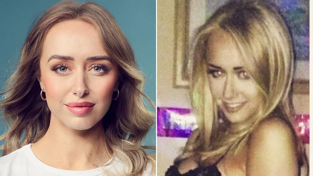 I started having lip filler at 21, and Botox at 27. My eyebrows and my lip colour are tattooed and I've spent thousands staying youthful. Older women think I'm mad... but this is my one, surprising worry: AMIE-BETH STEADMAN