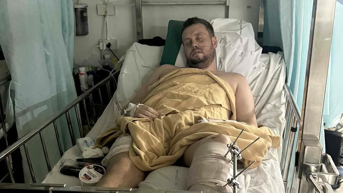 Brit left with his leg 'hanging off' after moped crash in Thailand pleads for help paying £20,000 medical bill because his travel insurance does not cover bike accidents