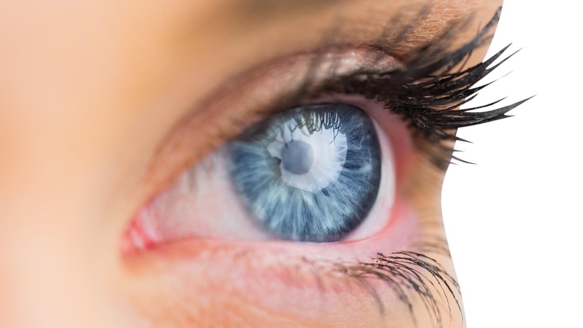 Experts pinpoint bacteria in the eyes that could drive dementia - discovery heralds treatment to PREVENT deadly condition