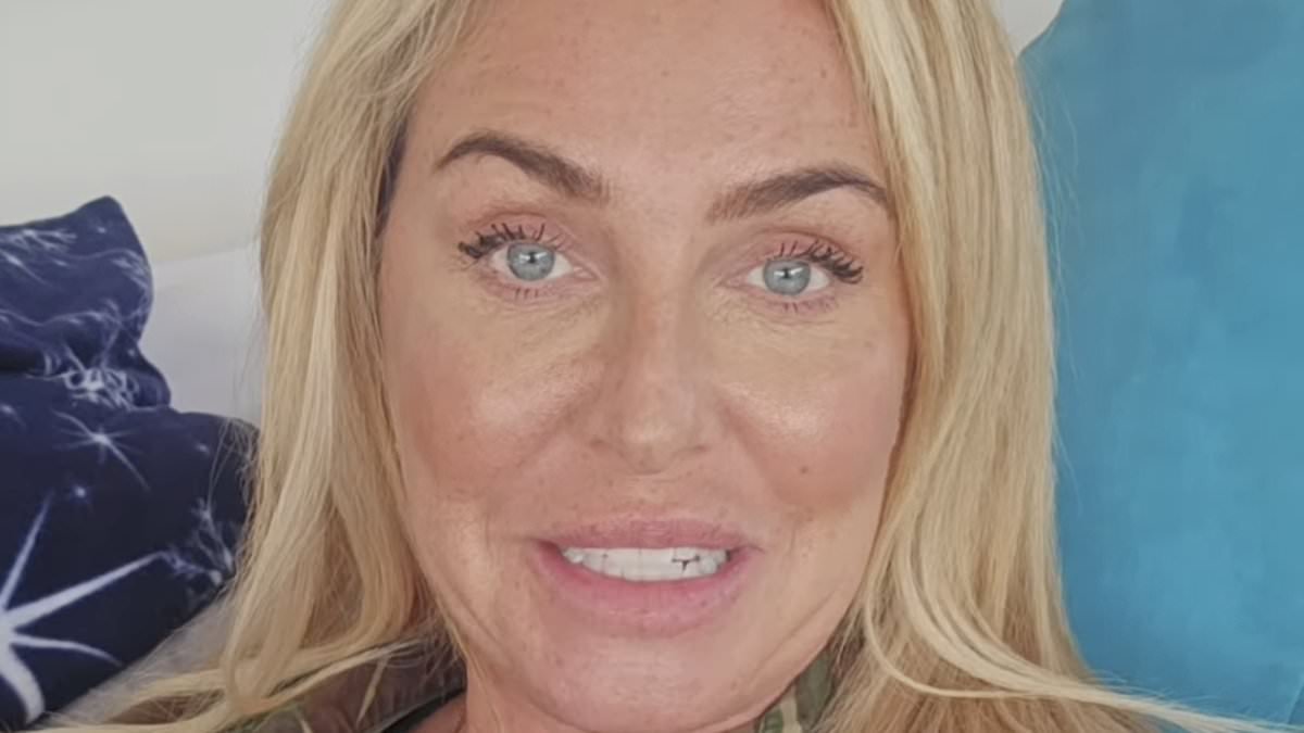 Josie Gibson reveals she had 45 per cent of her arm removed in liposuction surgery amid lipoedema battle