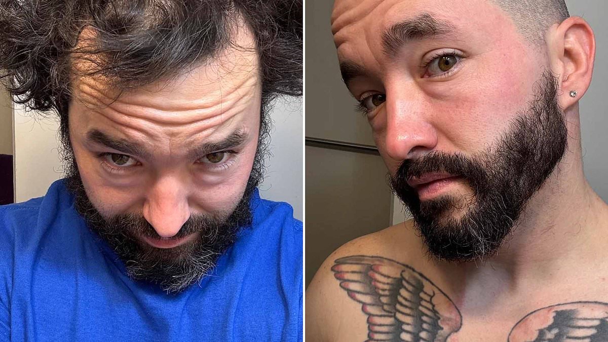 Hairless heroes! Inside the online community where balding men encourage one another to shave their heads - and heap praise on their astounding new looks