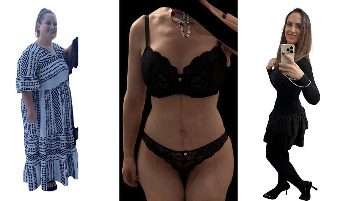 I lost 8.5 stone - but the 'apron of skin' left behind hit my confidence just as much as the weight had. Then one five-hour procedure got rid of my sagging bingo wings and left me feeling better than ever