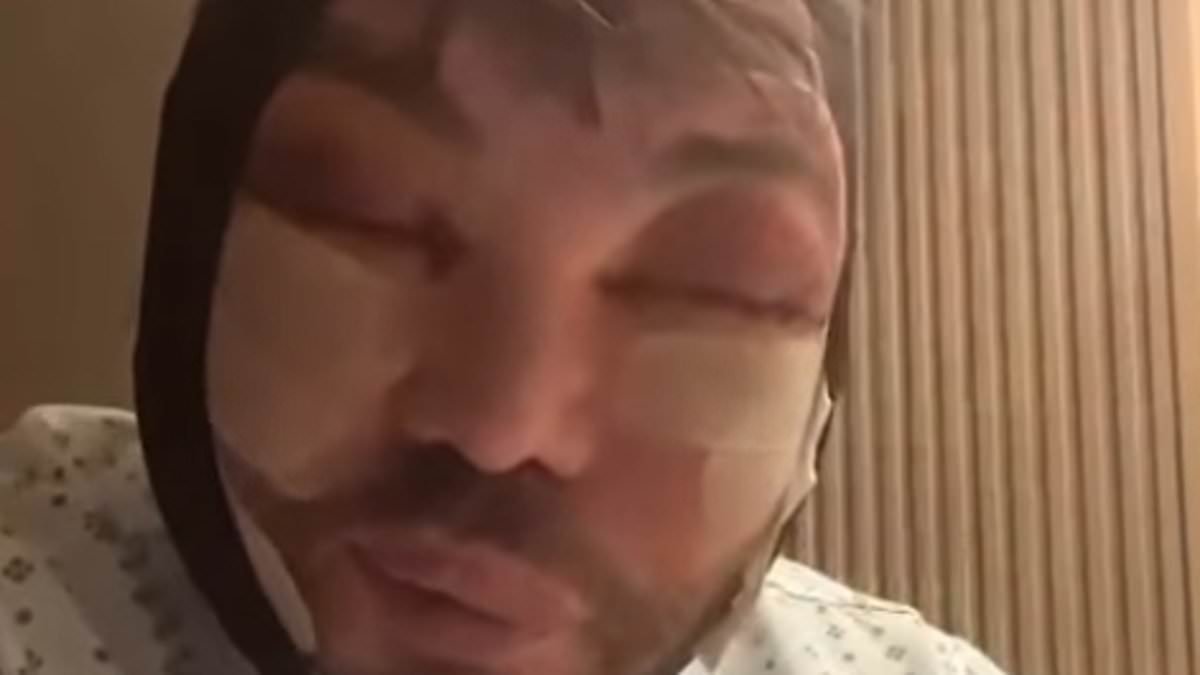 TOWIE's Bobby Norris says he is suffering with insomnia as he shows off his swollen face in new update after undergoing more cosmetic surgery