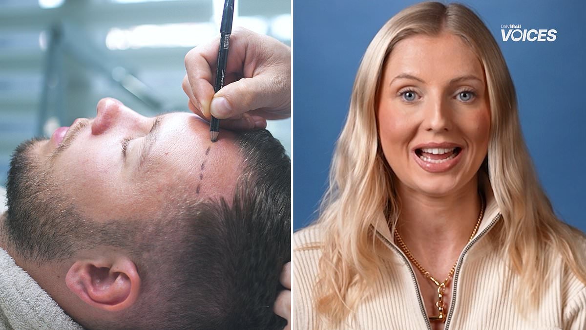 HANNAH SKELLEY: Inside the baldness boom - how young men and social media turned Turkey into the world's hair‑transplant hub