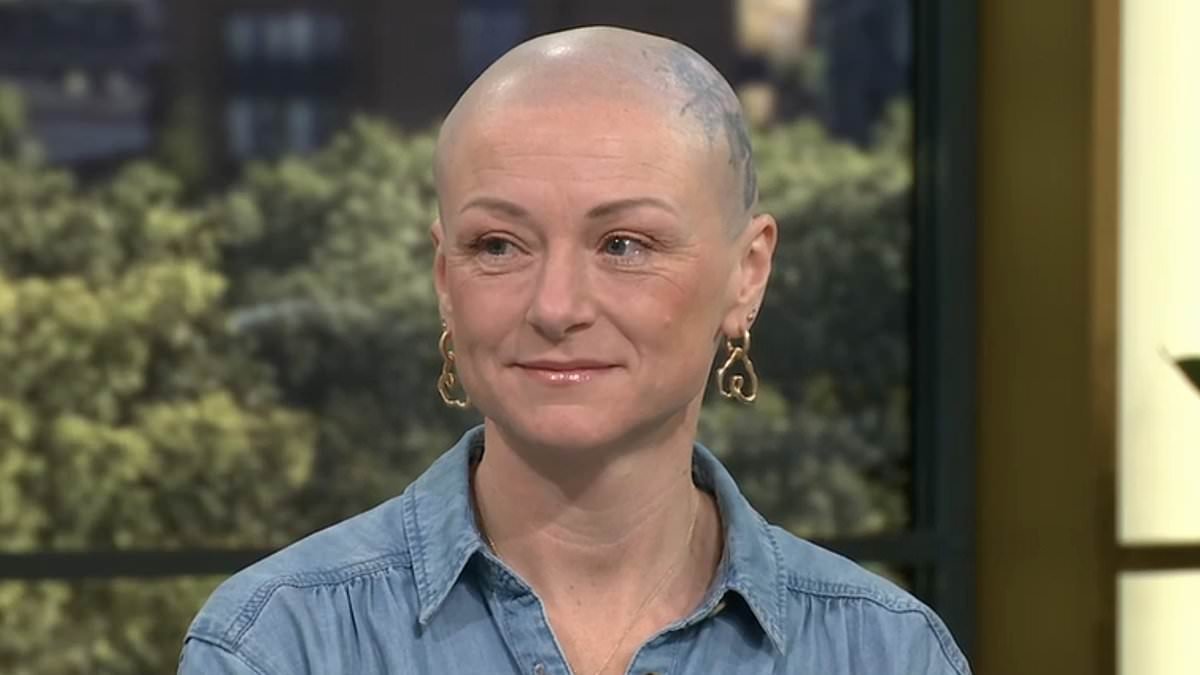 I've been pulling my hair out my whole life and hid my bald patches for years - I've tried therapy and medications but have realised there's only one solution that works for me