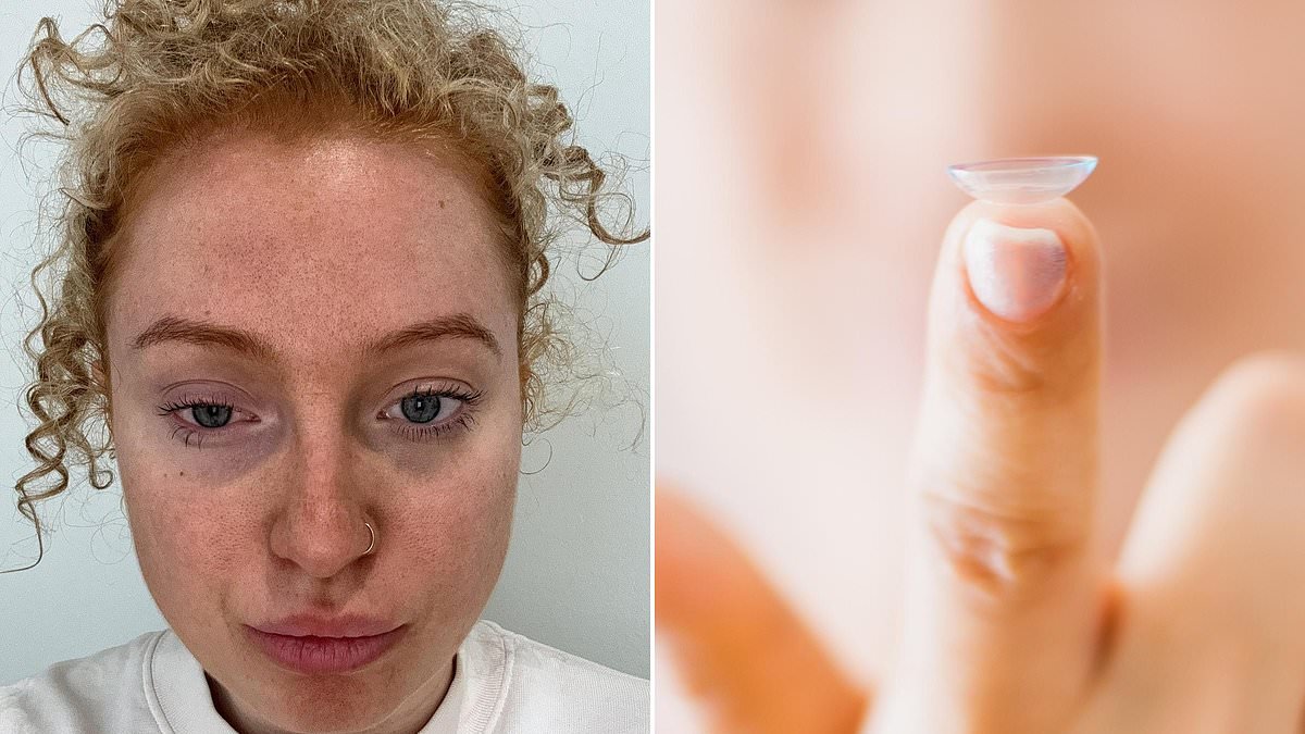 The easy mistake I made with my contact lenses that landed me in hospital - and nearly made me go BLIND for life. SCARLETT DARGAN reveals the terrifying ordeal that could happen to anyone