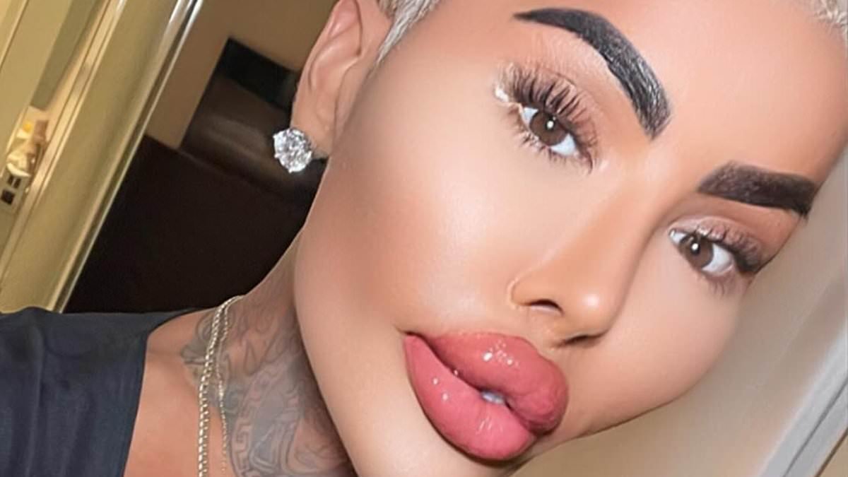 Kim Kardashian-obsessed 'Lip King' dies a year after he was arrested over death of mother-of-five who passed away following BBL at his clinic