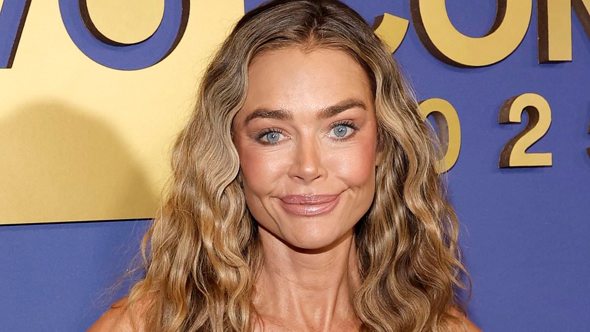 Denise Richards's plastic surgeon reveals stunning before-and-after photos of her facelift