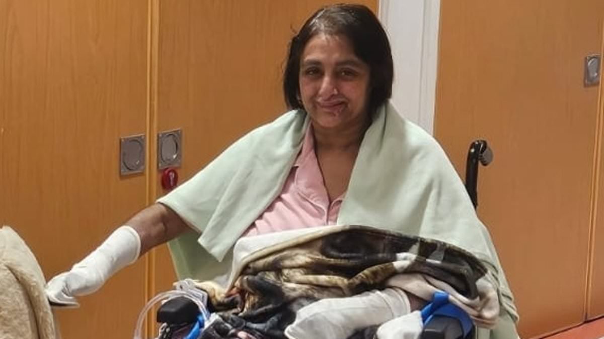 Woman loses all her limbs 'after being licked by a dog' in devastating case of sepsis that caused her heart to stop six times in intensive care