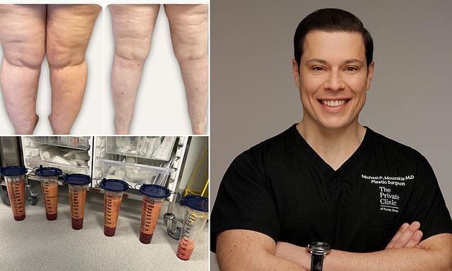 Why that menopausal fat really WON'T budge: Medical condition that affects women sees weight pile on 'seemingly overnight' - but hope IS at hand. Here's how to shift it