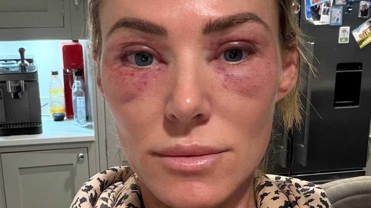 SARAH LINDSAY: At 45 I had crepey eyes and wrinkles - here's how I turned back the clock, and no, it's not Botox!