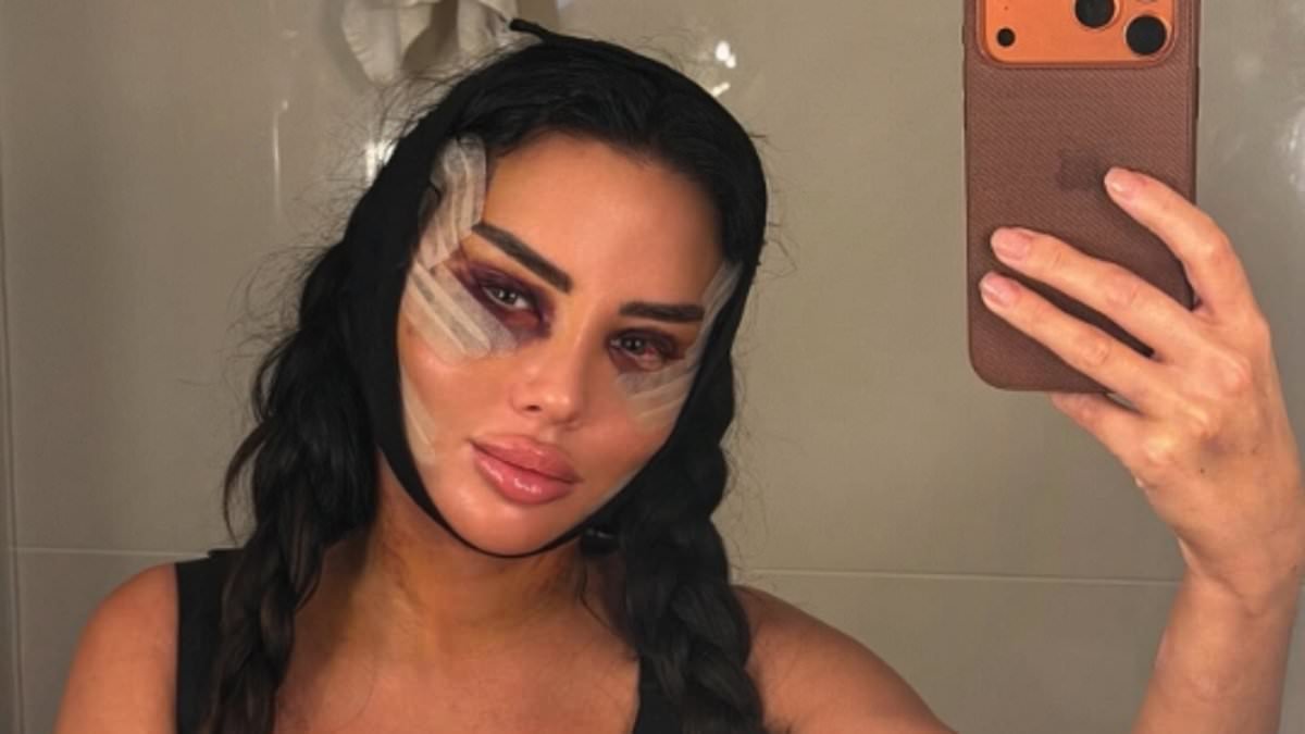 Yazmin Oukhellou, 31, shares painful recovery snap and reveals details about her latest cosmetic surgeries as she admits going under the knife for the last eight years