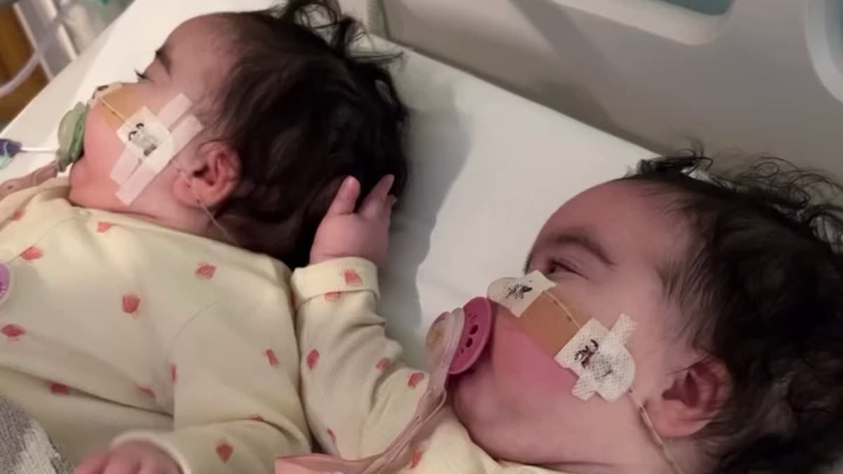 Jesy Nelson reveals twin daughters, 9 months, are being treated at Great Ormond Street Hospital as she shares heartbreaking picture of their matching leg splints amid their ongoing treatment for SMA