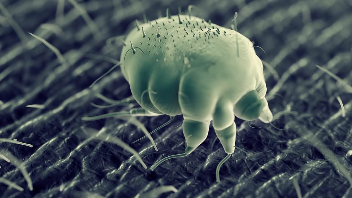 Public health officials issue alert as cases of scabies rise sharply - one patient warns: 'It was hell... I wouldn't wish it on my worst enemy'