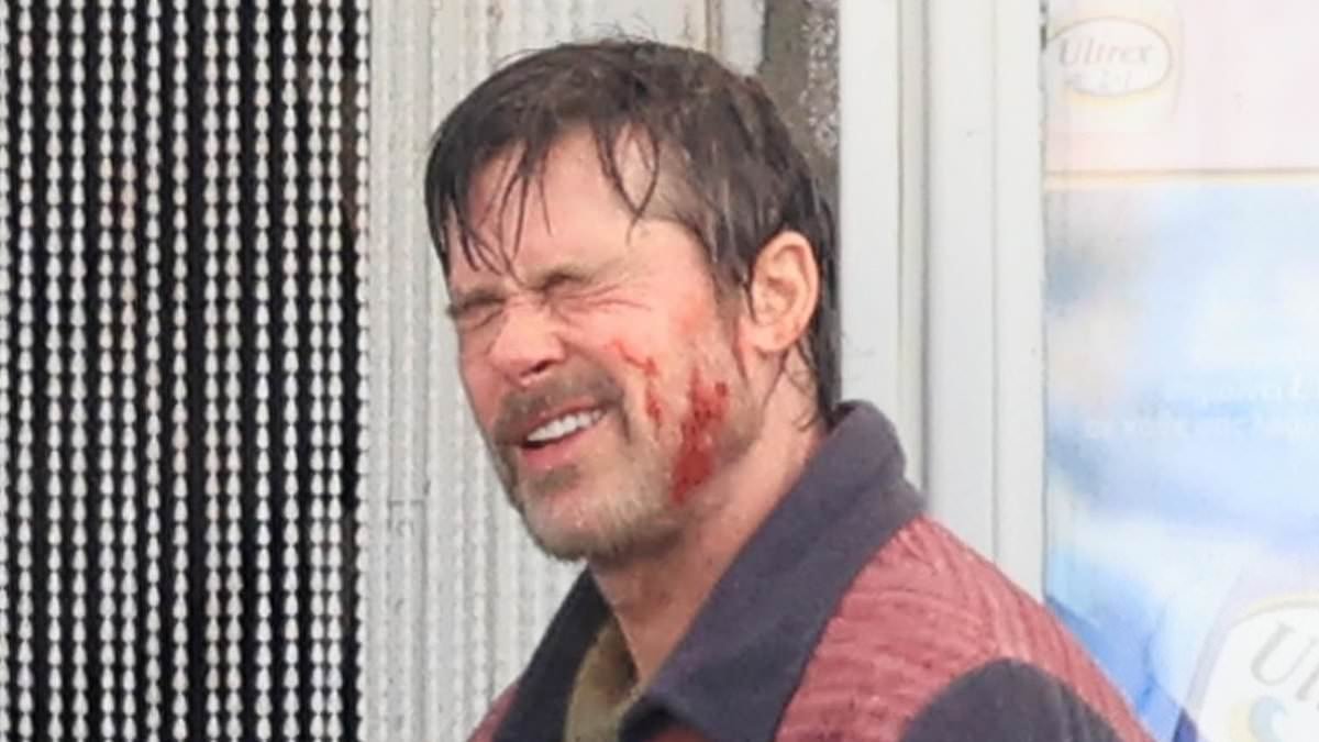 Brad Pitt is bloodied and bruised as he gets to work on the set of his new movie The Riders in Greece