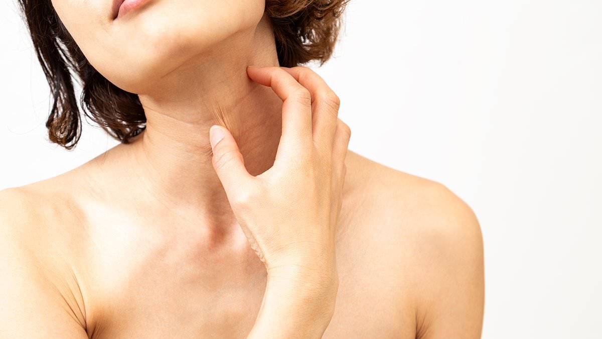 Do you have 'winter eczema'? Top skin doctor EMMA CRAYTHORNE has the answer, with all the best supplements, moisturisers, creams and brilliant lifestyle tips to end the misery