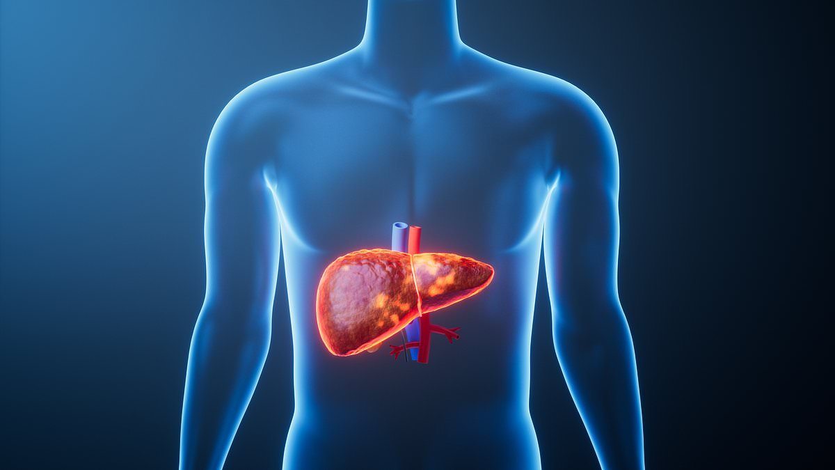 Liver disease epidemic: Deadly disease now striking non-drinkers in record numbers - 1.8bn hit by 2050... and most don't know they have it