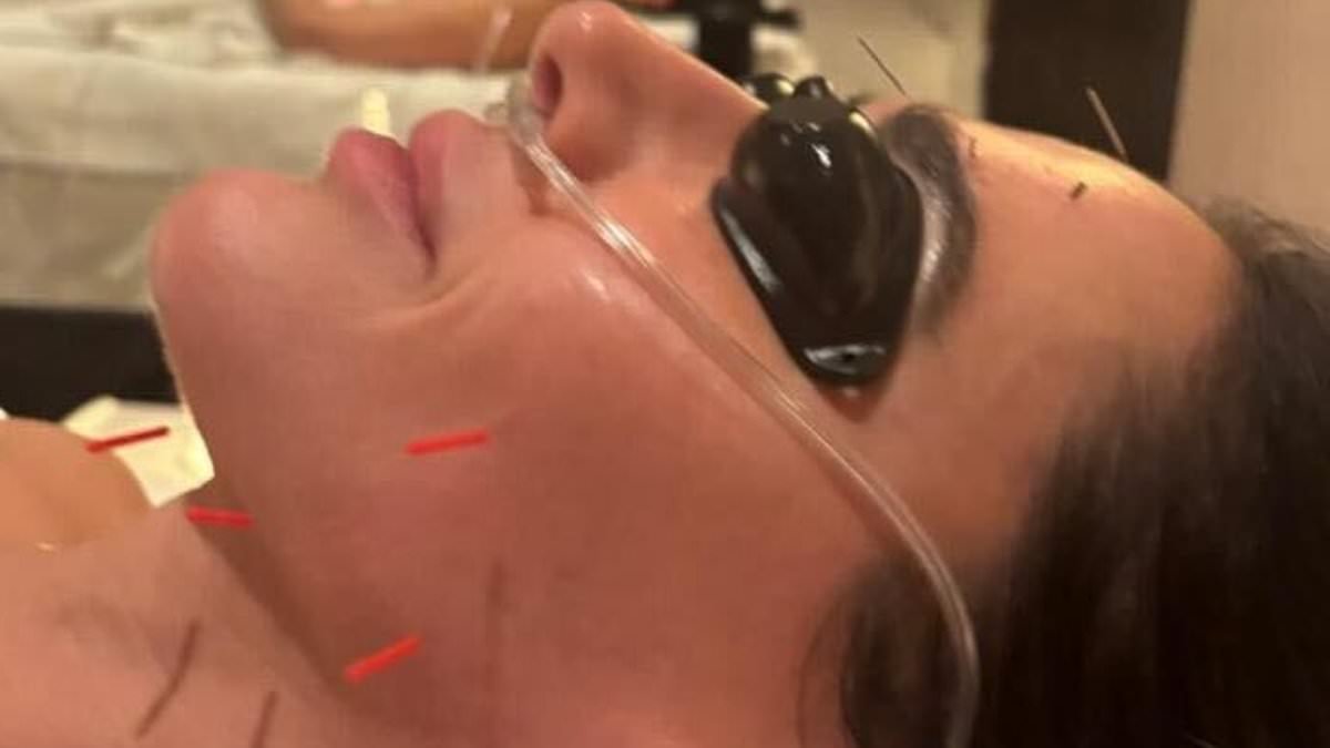 Simon Cowell, 66, enjoys extreme £500 pampering treatment with partner Lauren Silverman, 48, as they relax with a face full of needles