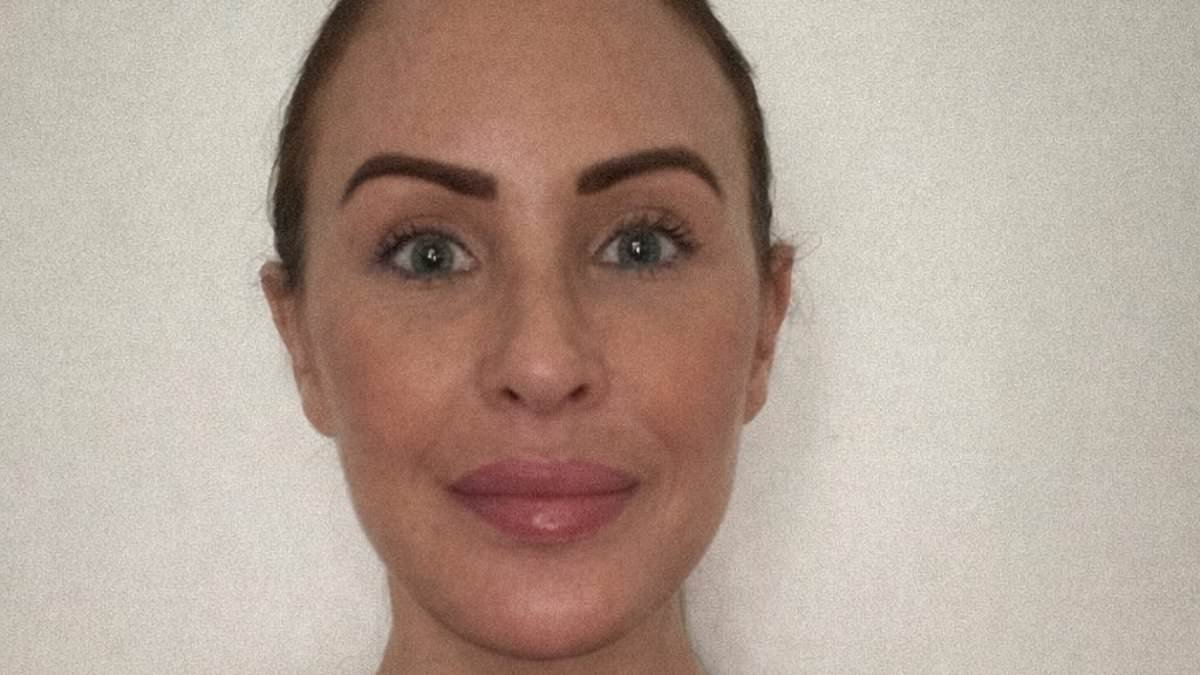 I paid £10,000 for a facelift in Turkey - cruel trolls say it's made me look older