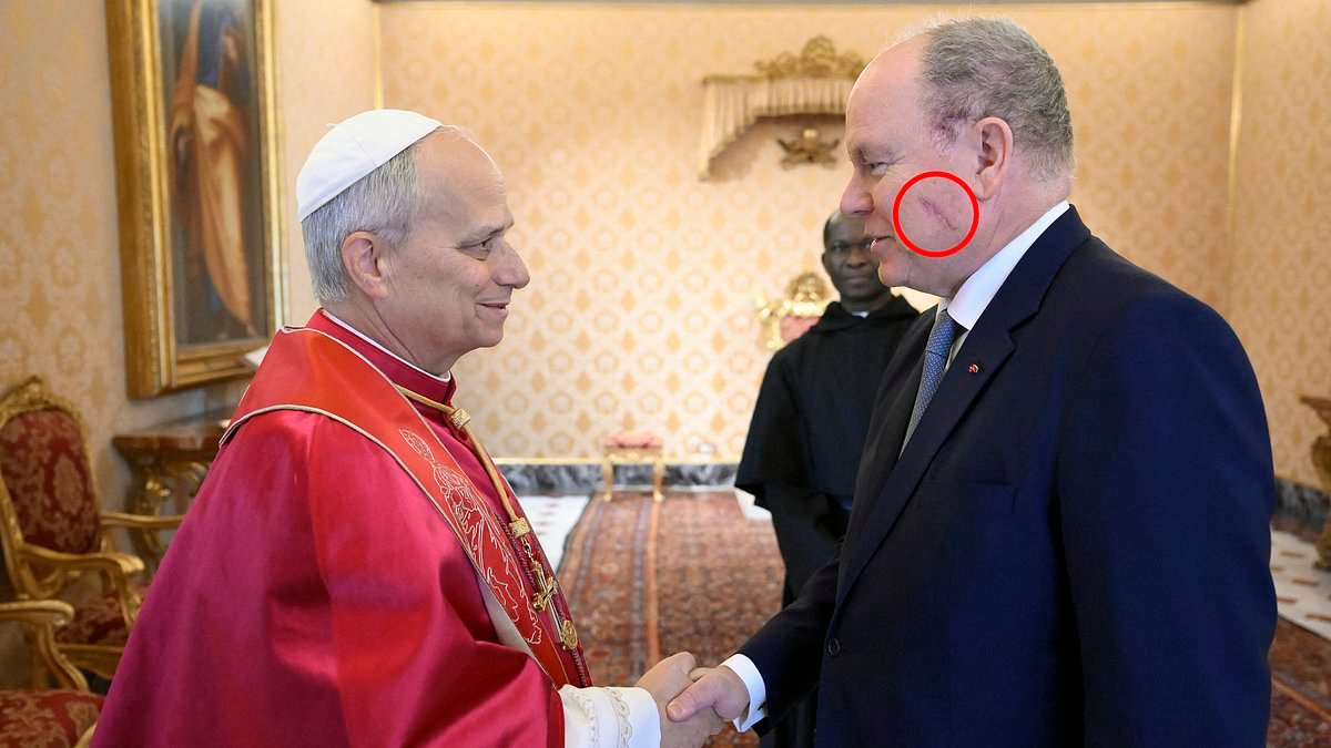 Prince Albert seen with large scar on cheek as he meets Pope - hours after Palace of Monaco announced he had procedure on scalp and face