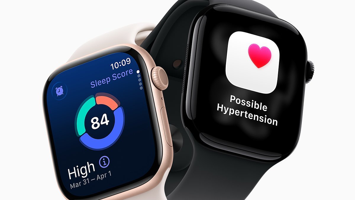 Give Apple watches to patients with heart rhythm disorder urge experts