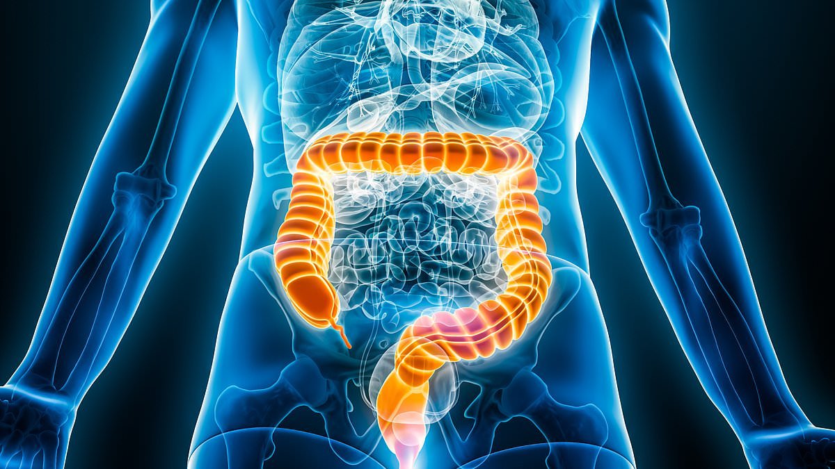 Truth behind terrifying rise of bowel cancer in people under 50: I'm an expert and these are ALL the potential causes of the disease... and the daily habit you must ditch now