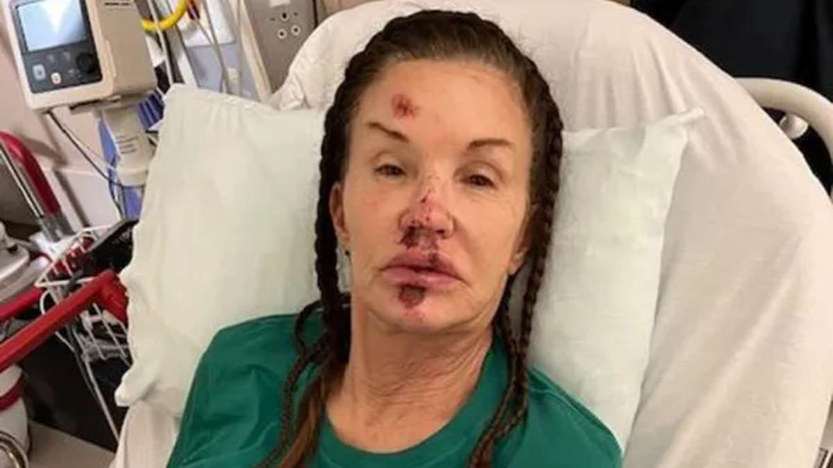 I'm A Celebrity bosses 'blame Janice Dickinson for horror fall' as ongoing row with ITV continues amid lawsuit