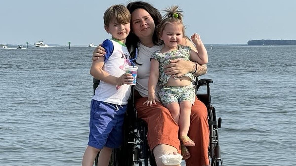 Doctors told me I was faking my pain... until tests revealed my skull was crushing my brain