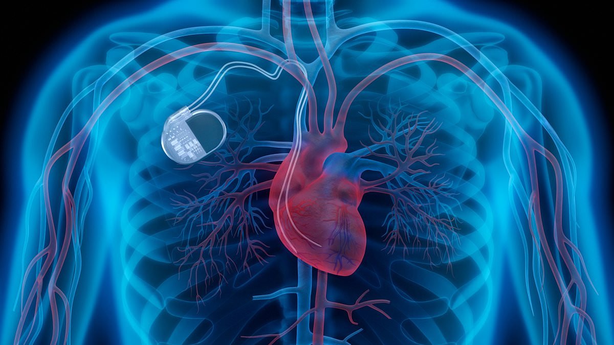 Pacemaker the size of a watch that switches your heart to burn fat rather than sugar